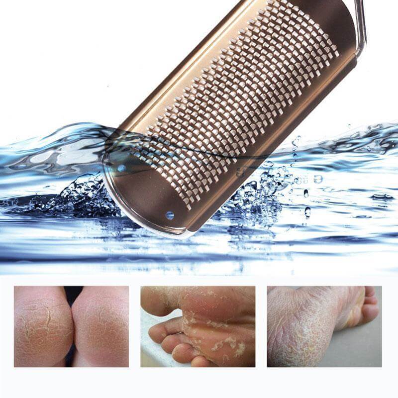 Foot File Callus Remover