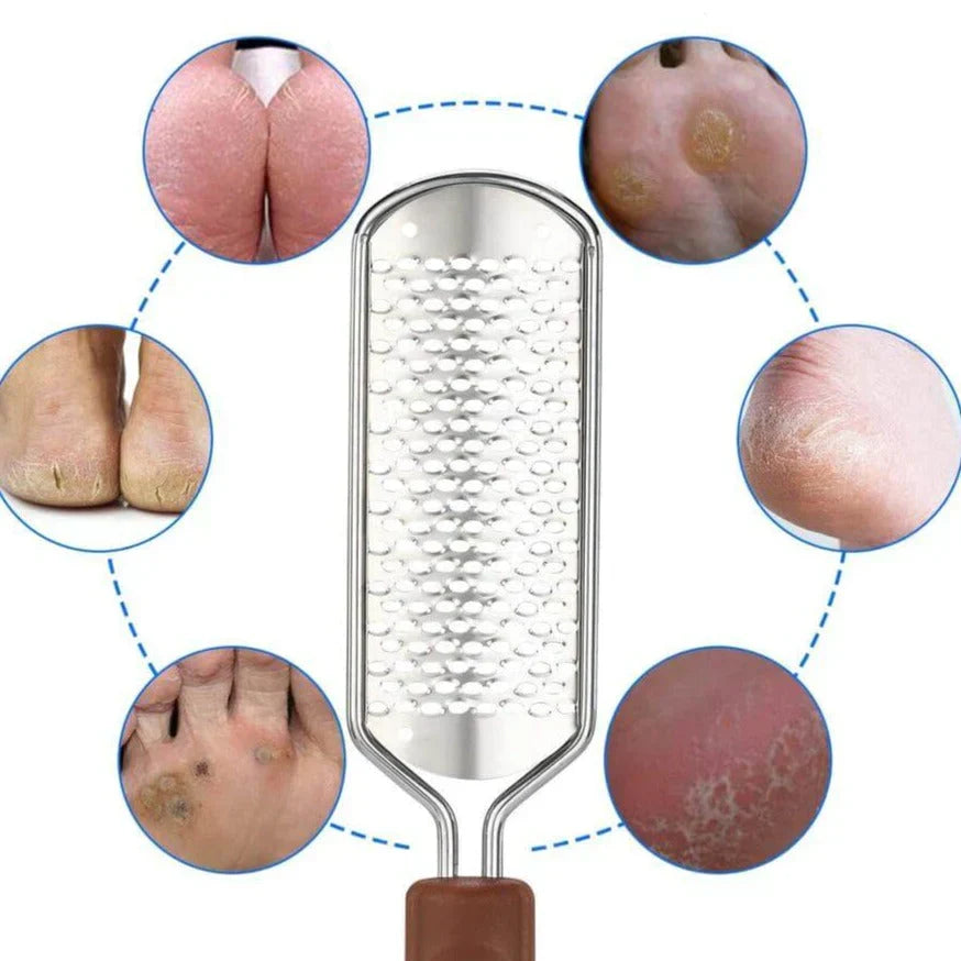 Foot File Callus Remover